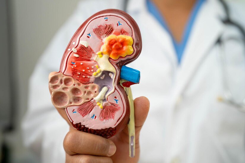 https://yupiterhospital.com/wp-content/uploads/2024/09/Nephrology-Dialysis.jpg